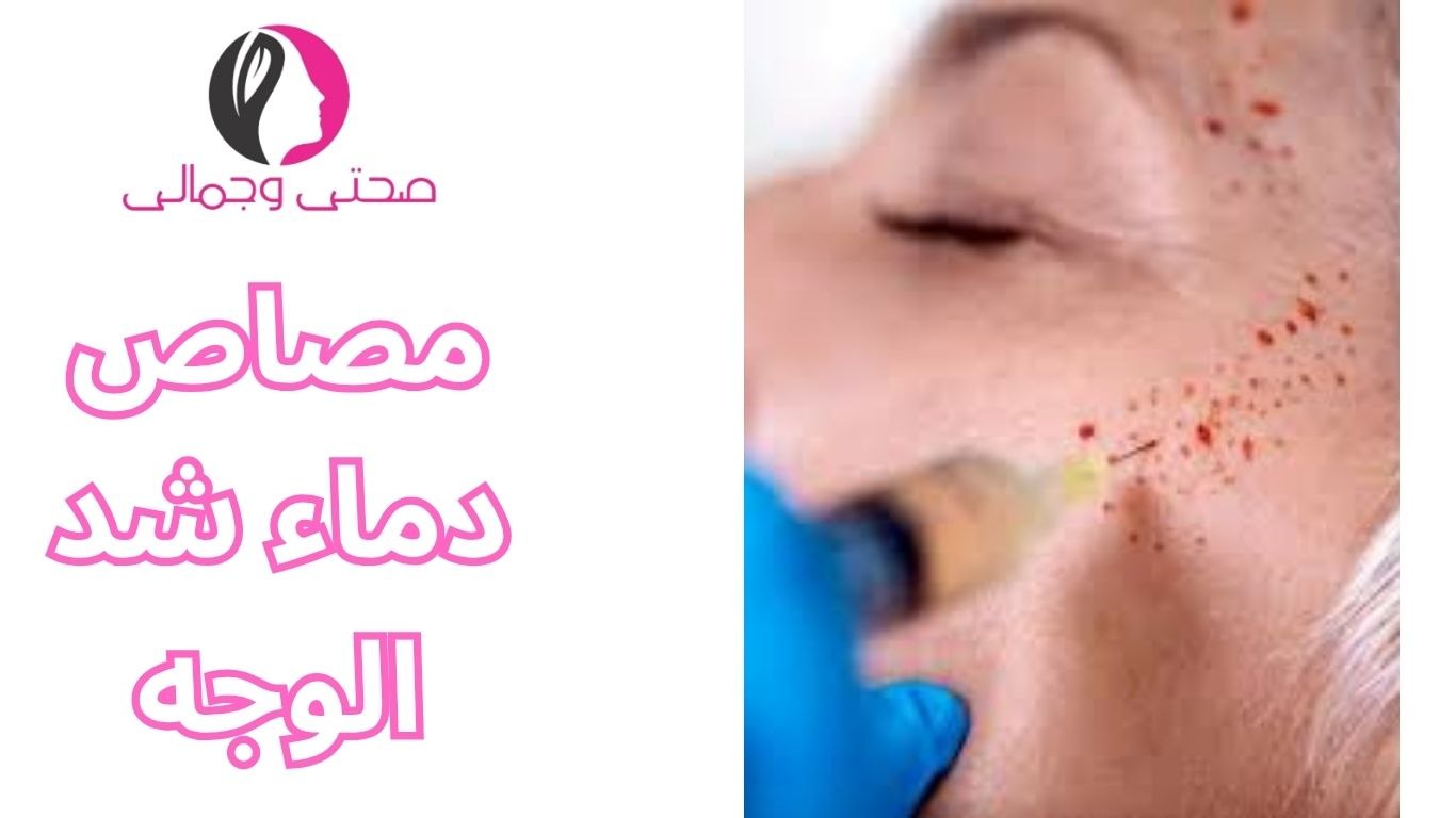 مصاص دماء شد الوجه