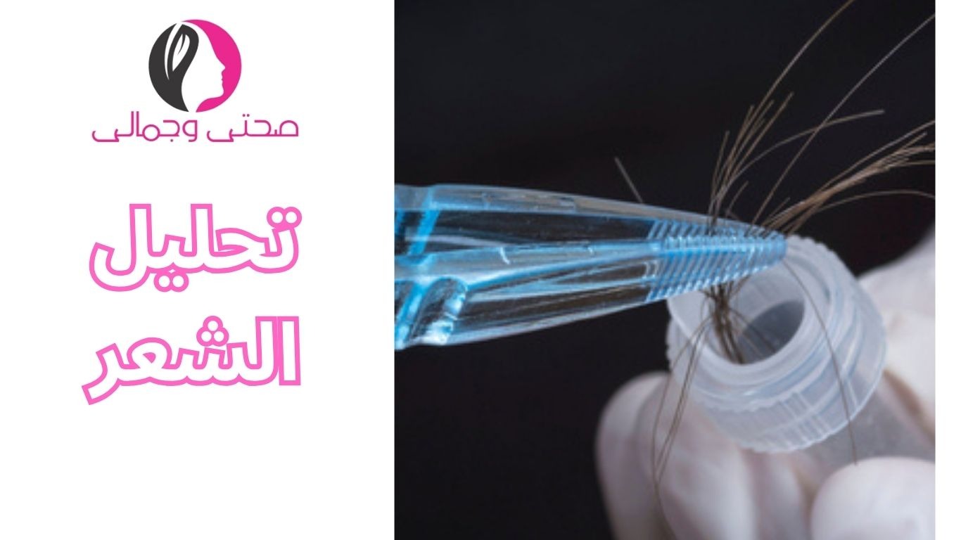 تحليل الشعر