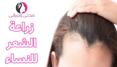 زراعة الشعر للنساء