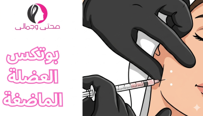 بوتكس العضلة الماضغة
