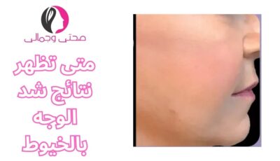 متى تظهر نتائج شد الوجه بالخيوط