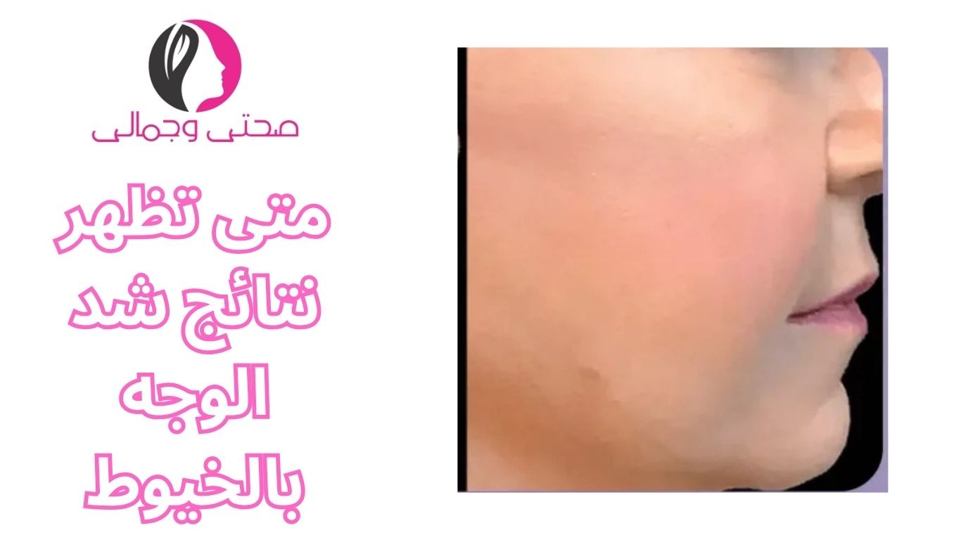 متى تظهر نتائج شد الوجه بالخيوط